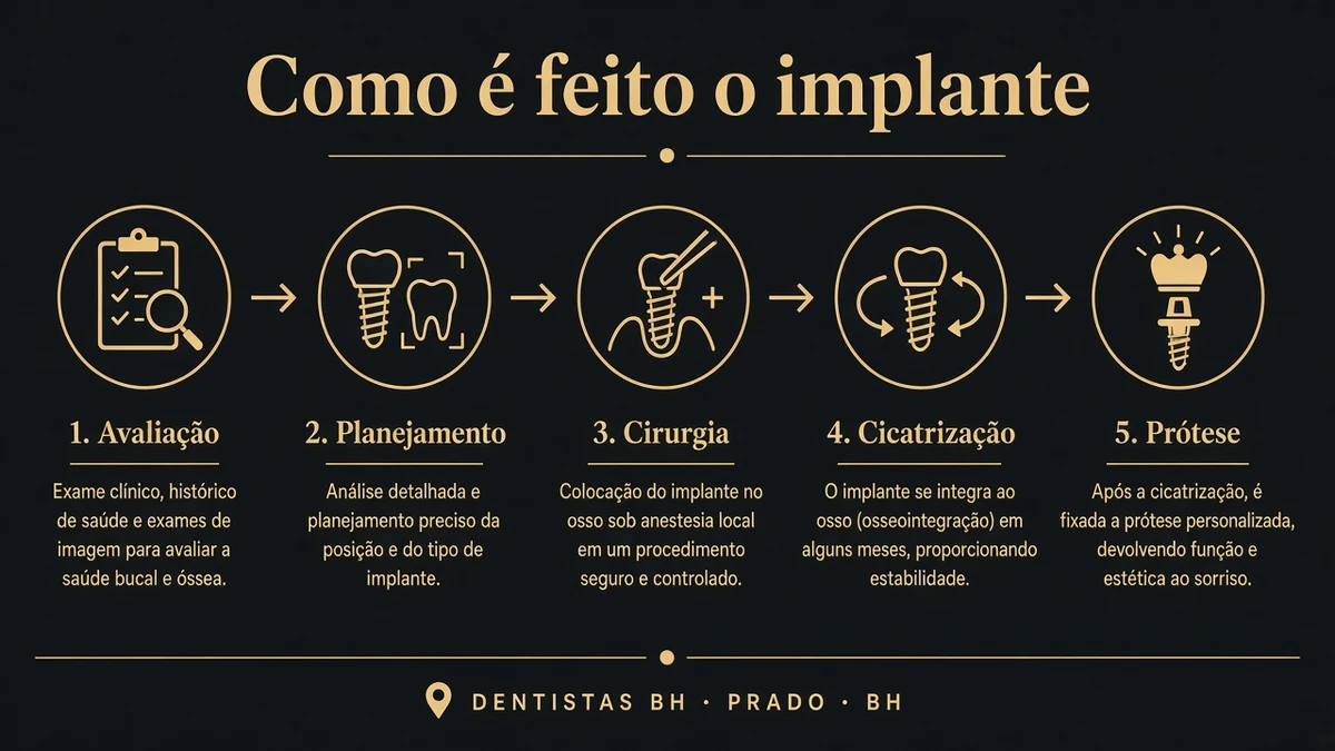 Infográfico 1 — como e feito implante dentario — Dentistas BH, Prado, BH