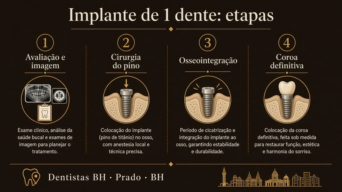 Infográfico 1 — implante de 1 dente — Dentistas BH, Prado, BH