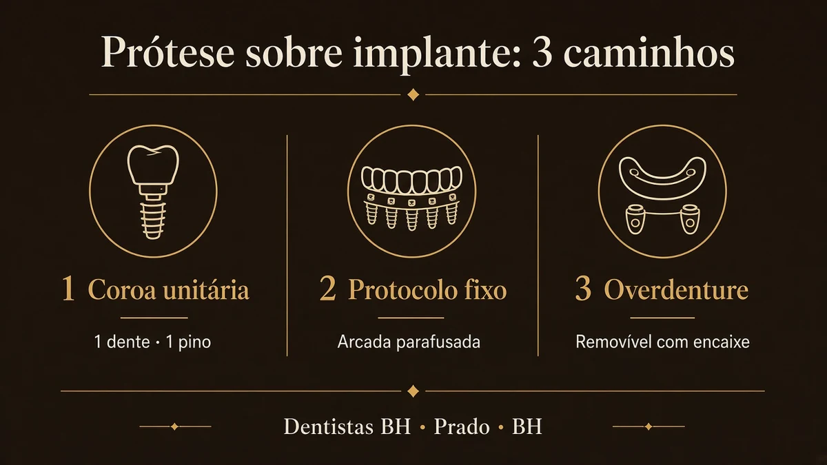 Infográfico: três caminhos de prótese sobre implante — coroa unitária, protocolo fixo e overdenture — Dentistas BH, Prado, BH