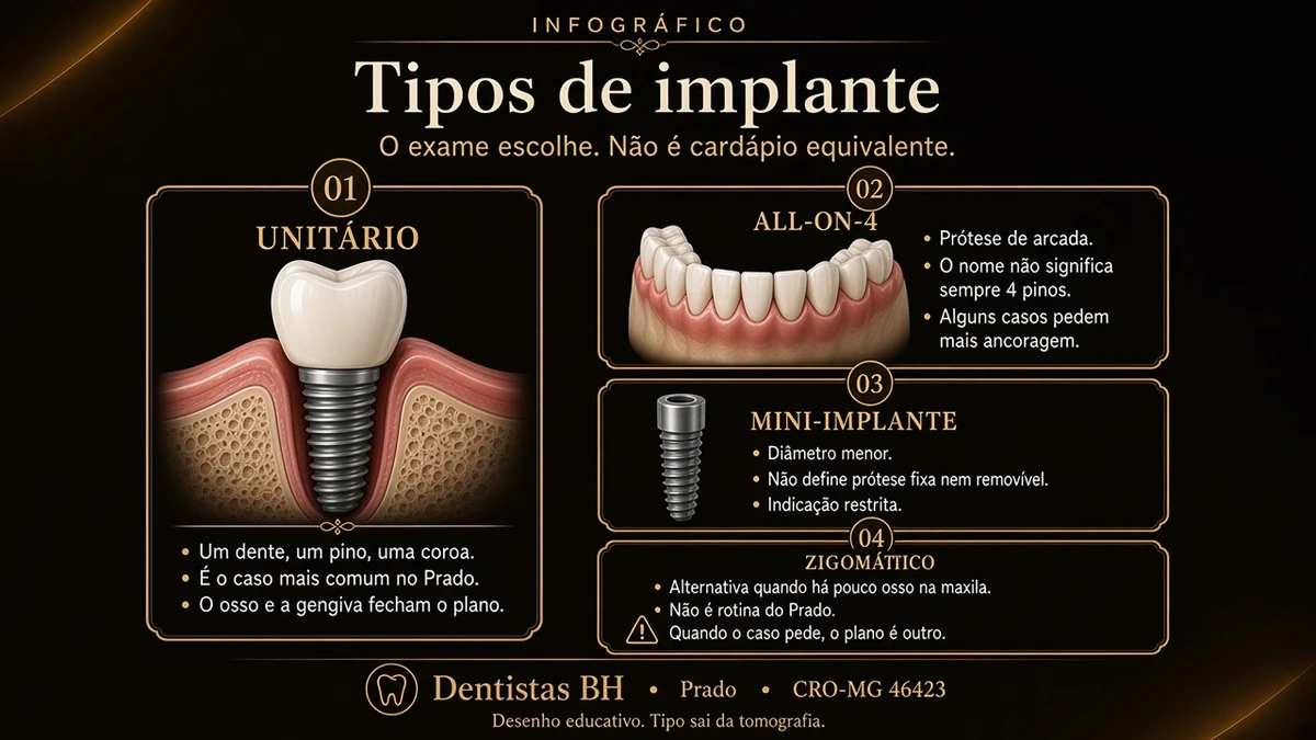 Desenho dos tipos de implante com o unitário em destaque, All-on-4 sem número fixo de pinos, mini-implante sem tipo de prótese e zigomático como alternativa de pouco osso, Dentistas BH, Prado